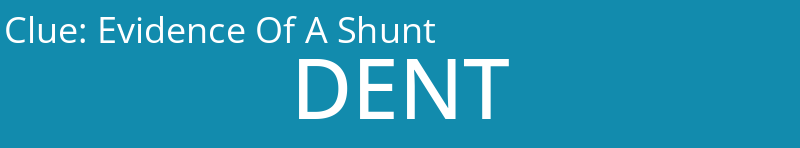 Evidence Of A Shunt