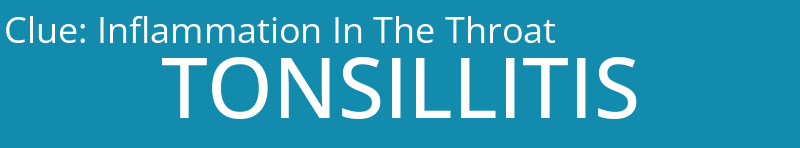 Inflammation In The Throat