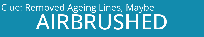 Removed Ageing Lines, Maybe