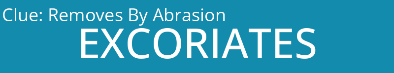 Removes By Abrasion